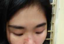 Mahasiswi WD Dianiaya “Pria Jantan”