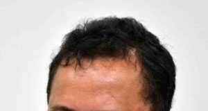 SE Kapolri Tak Bermanfaat dan Lebay!