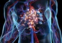 Tips Mengurangi Penyakit Jantung