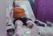 Tabung Gas Meledak RM Imelda 2 Hangus