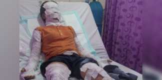 Tabung Gas Meledak RM Imelda 2 Hangus