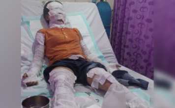 Tabung Gas Meledak RM Imelda 2 Hangus