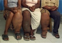 Tiap Kecamatan Diberikan Pelatihan POPM Filaria Dua Hari