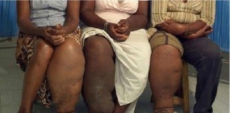 Tiap Kecamatan Diberikan Pelatihan POPM Filaria Dua Hari