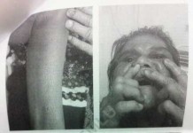 TKW Disiksa Warga Malaysia