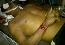 Korban Tabrak Lari Tewas Mengenaskan