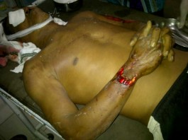 Korban Tabrak Lari Tewas Mengenaskan