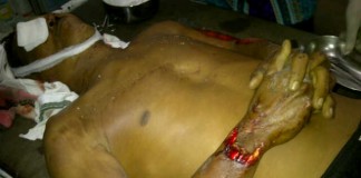 Korban Tabrak Lari Tewas Mengenaskan