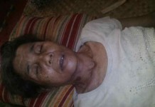 Tebang Bambu Tersengat Listrik