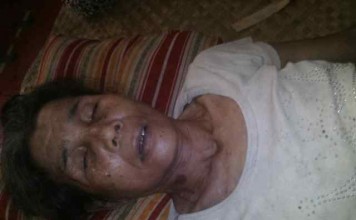 Tebang Bambu Tersengat Listrik