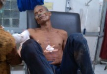 Dikira Binatang, Teman Berburu pun Ditembak