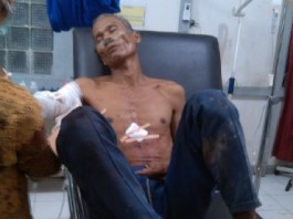 Dikira Binatang, Teman Berburu pun Ditembak