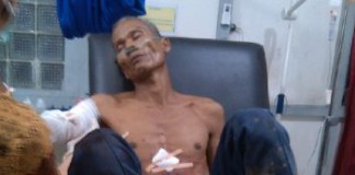 Dikira Binatang, Teman Berburu pun Ditembak