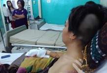 Ditebas Mandau Jari Manis Putus