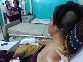 Ditebas Mandau Jari Manis Putus