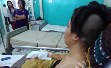 Ditebas Mandau Jari Manis Putus