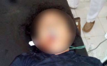 Trisia Tewas Disenggol Truk