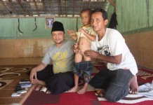 Bocah Memiliki Dua Kelamin