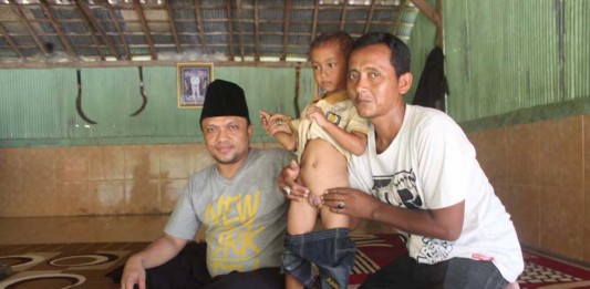 Bocah Memiliki Dua Kelamin