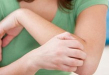 Pantau Penderita Gatal-gatal