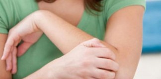 Pantau Penderita Gatal-gatal