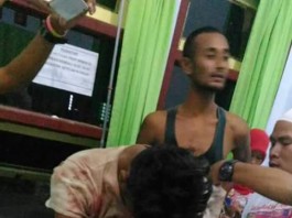 Ngeri Ditebas Tangan Terputus