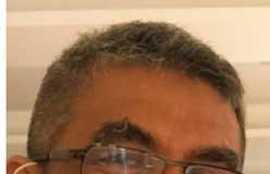 Flu Burung Muncul (Lagi)