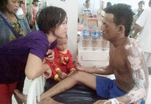 Kapal Bandong Meledak Tujuh Luka Bakar