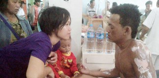 Kapal Bandong Meledak Tujuh Luka Bakar