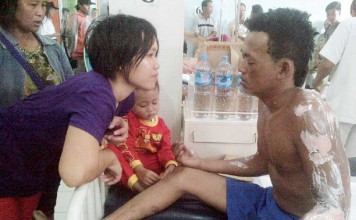 Kapal Bandong Meledak Tujuh Luka Bakar