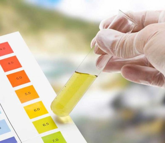 Jelas Arus Mudik dan Balik, Pengemudi Akan Dites Urin