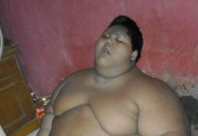 Usia 10 Tahun Berat 140 Kg