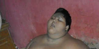 Usia 10 Tahun Berat 140 Kg