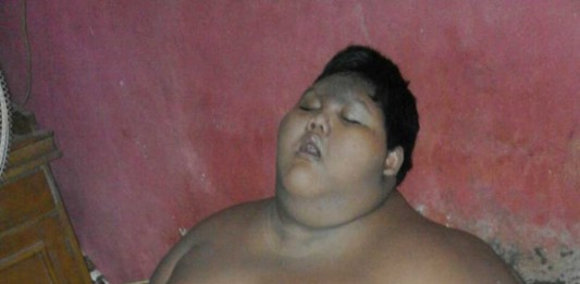 Usia 10 Tahun Berat 140 Kg