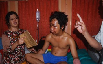 Muka Bonyok, Kepala Rutan Bilang Jatuh di Kamar Mandi