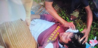 Terseret KA 15 Meter, Siswa SMAN 5 Lolos dari Maut