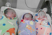 RSUD Landak Tangani Bayi Kembar Tiga