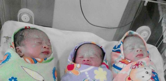 RSUD Landak Tangani Bayi Kembar Tiga