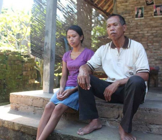 Kisah Ni Wayan Tina Mariani, Gadis Yang Berjuang Melawan Tumor Tulang Belakang