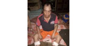 “Main” Kejar-kejaran dengan Polisi Dor! Curanmor Tersungkur