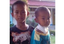 Rabies Membahana di Sejumlah Kabupaten, Leher Digigit Anjing, Batita Dioperasi