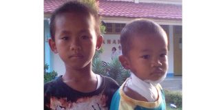 Rabies Membahana di Sejumlah Kabupaten, Leher Digigit Anjing, Batita Dioperasi