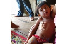 Ibu Dikeroyok, Rumah Dirusak, Bocah Empat Tahun Luka Parah