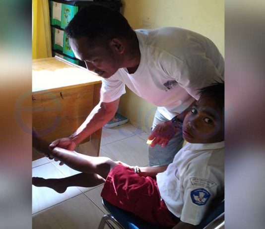 Mau Ambil Jambu di Belakang Rumah, Murid SD Digigit Anjing