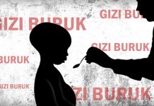 Miris… 83 Balita Menderita Gizi Buruk
