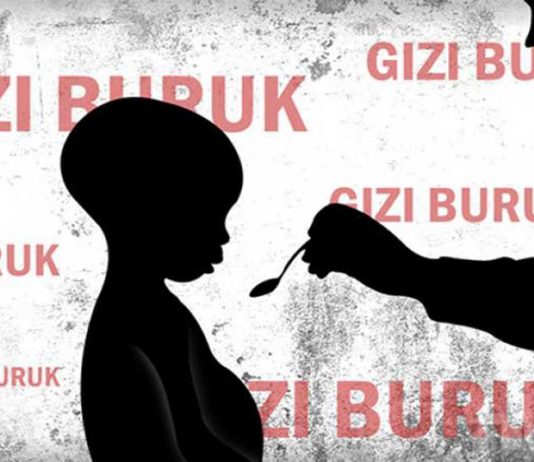 2017, Kasus Gizi Buruk KKU Makin Menyusut