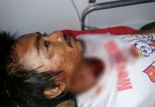 Merajuk Ditinggal Istri Gorok Leher Sendiri