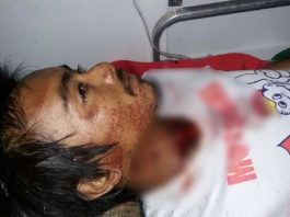 Merajuk Ditinggal Istri Gorok Leher Sendiri