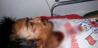 Merajuk Ditinggal Istri Gorok Leher Sendiri