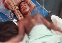 Bantah Curi Handphone, Dibakar Hidup-hidup